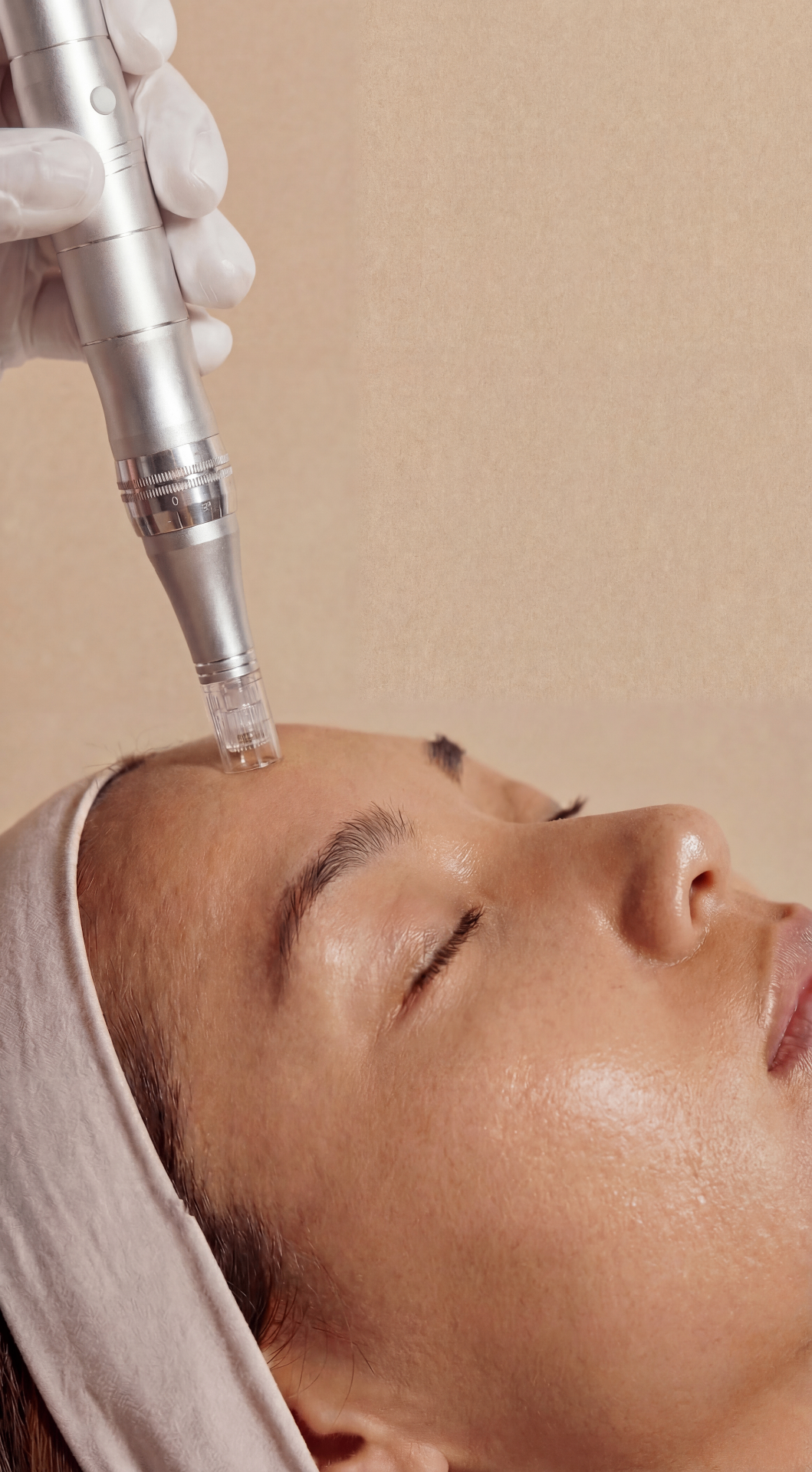 Microneedling & Plasma at Beauty Ranch by Nurse Jamie