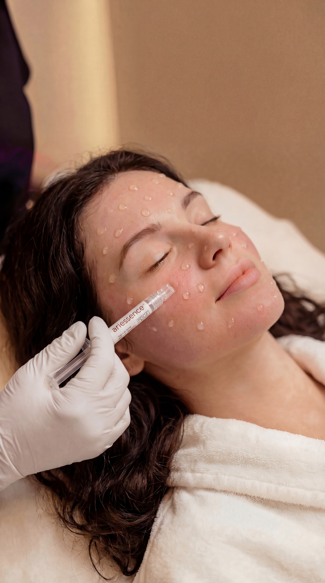 Rejuran PDRN treatment